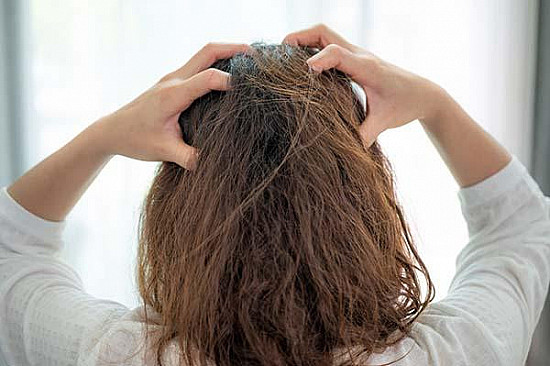 What may probably be inflicting your itchy scalp?